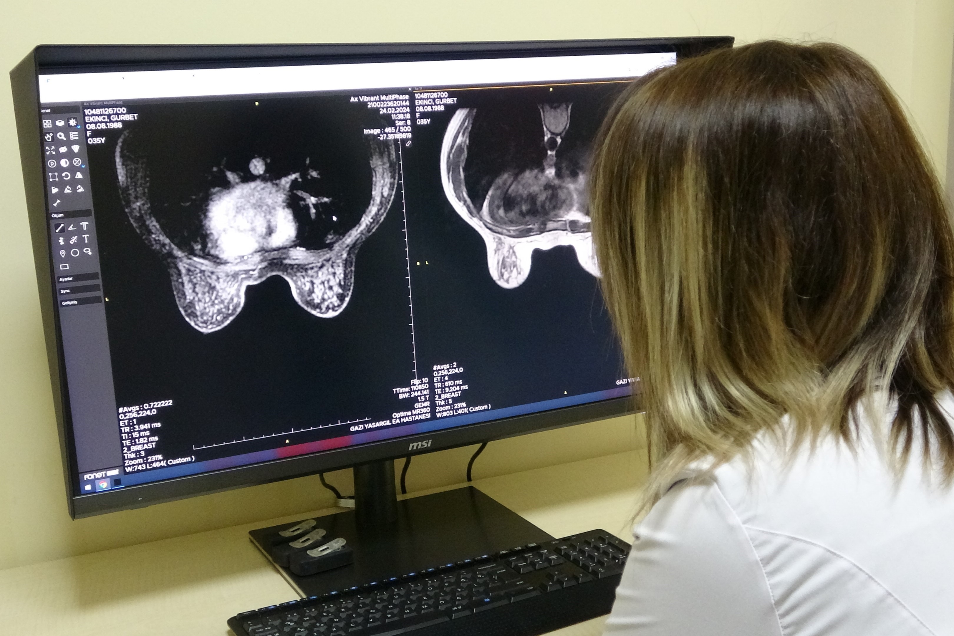 Dünyada her 8 kadından biri meme kanseri!