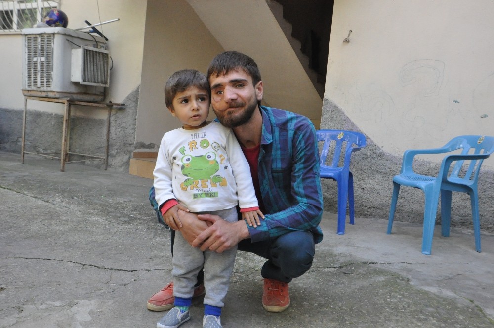 38 kez ameliyat oldu, yüzü düzelmedi