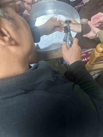 Batman&rsquo;da vatandaşın parmağına sıkışan y&uuml;z&uuml;k hastanede &ccedil;ıkarıldı