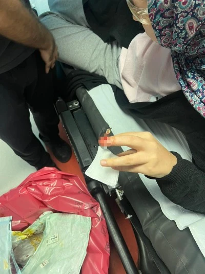 Batman’da Yemek Hazırlarken Parmağını Blendere Kaptırdı