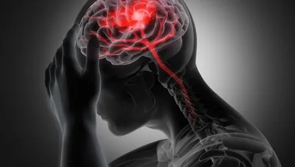 Beyin Kanamasından Korunmanın Yolları Nelerdir?