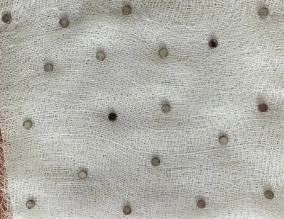 Doktorları Şoke Eden Olay: Küçük Çocuğun Boğazından 19 Mıknatıs Çıktı!