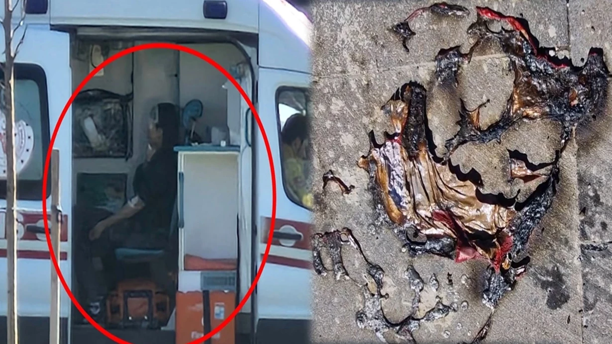 Diyarbakır'da Balonla Oyun Hastanede Bitti