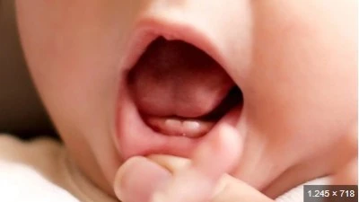 Diyarbakır'da Bebeklerde Diş Çıkarma ile Ateş ve İshal Karıştırılmamalı