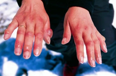 Diyarbakır&rsquo;da Dondurucu Soğuk Alarmı