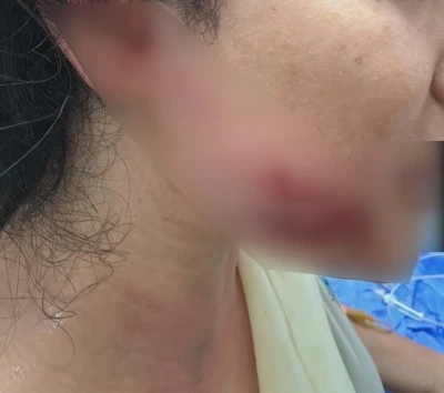 Diyarbakır&rsquo;da ma&ccedil; sevinci kabusa d&ouml;nd&uuml;: 2 kardeş yaralandı