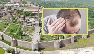 Diyarbakırlılarda Erken Saç Beyazlaması ve Kellik Sorunu