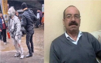 Ergani&rsquo;deki Soba Patlamasında Ağır Yaralanan Vatandaş Hayatını Kaybetti