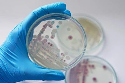 Et Yiyen Bakteri 9 Kişi Hayatını Kaybetti