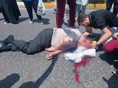 Feci Kaza: Yolun Karşısına Ge&ccedil;mek İsteyen Yaya Ağır Yaralandı 