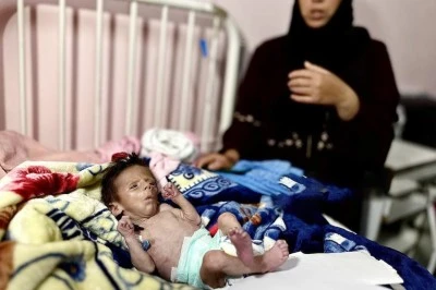 Gazze’de Açlıktan Ölümler Artıyor