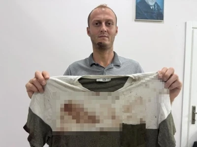 G&uuml;r&uuml;lt&uuml; tartışması sopalı kavgayla bitti: O anlar kamerada