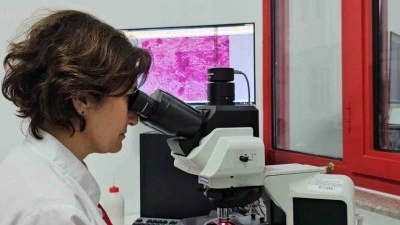 Kontrolsüzce çevreye bırakılan etler "kist hidatik enfeksiyonunun’ yayılmasına neden oluyor