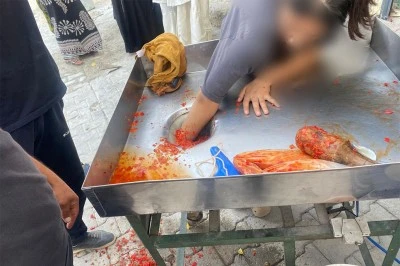 Şanlıurfa'da Salça Makinesine Eli Sıkışan Genç Kız İtfaiye Tarafından Kurtarıldı