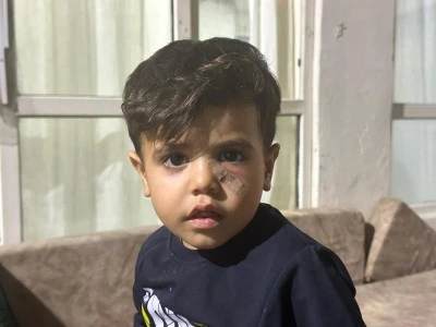 Şanlıurfa’da Yorgun Mermi Dehşeti: 4 Yaşındaki Çocuk Yüzünden Yaralandı