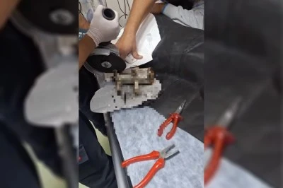 Şanlıurfa İtfaiyesi, Tel Abyad’da Kıyma Makinesine Sıkışan 8 Yaşındaki Kızın Elini Kurtardı