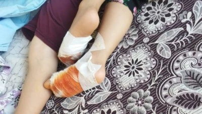 Sıcak hava tehlike saçıyor: Minik Yaren’in ayağı damda yandı