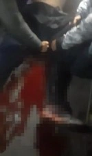 Üsküdar’da bıçaklı kavga : 1 yaralı