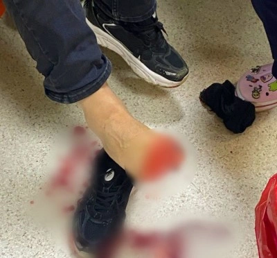 Uyuşturucu operasyonunda polise silahla ateş açıldı: 2 polis yaralandı