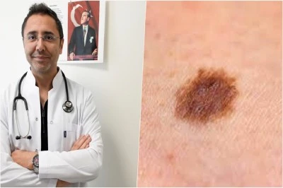 Uzmandan cilt kanseri uyarısı