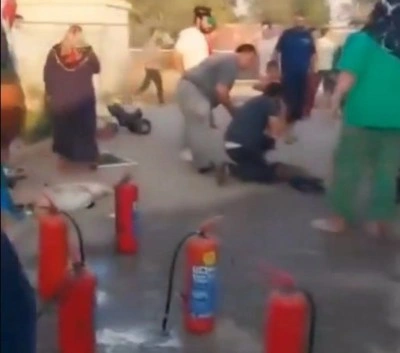 Yangında ağır yaralanan çocuk hayatını kaybetti