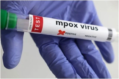 Yeni Mpox Varyantı İngiltere’de Tespit Edildi